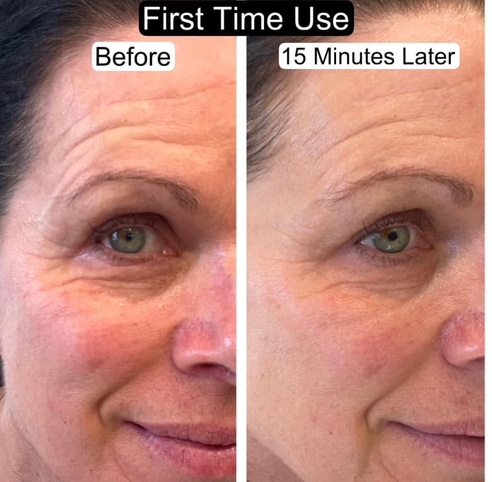 Skin result — first use