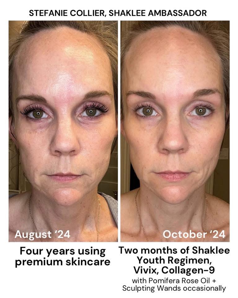 Skin result — 2 months