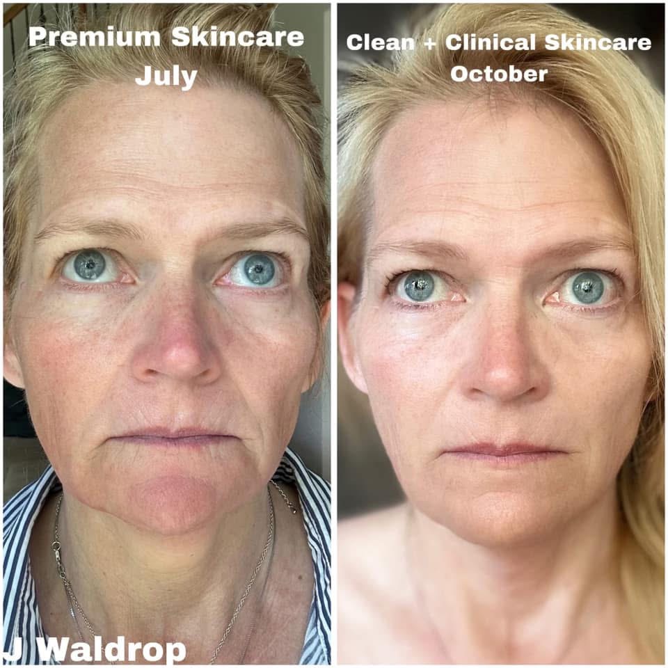 Skin result — switch story