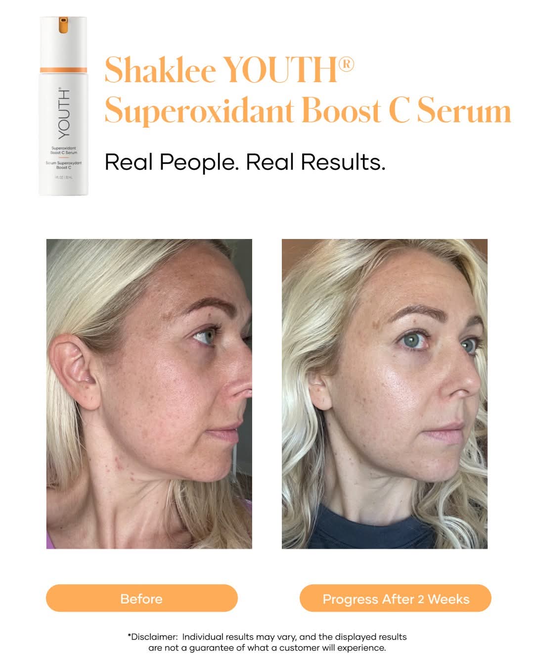 Skin result — 2 weeks